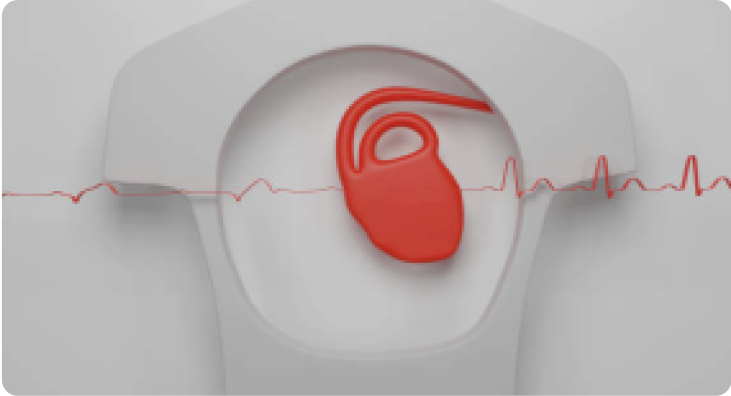 Biventricular Device CRT - Cardiac Resynchronization Therapy